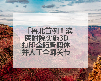 鲁北首例！滨医附院实施3D打印全距骨假体并人工全踝关节置换术